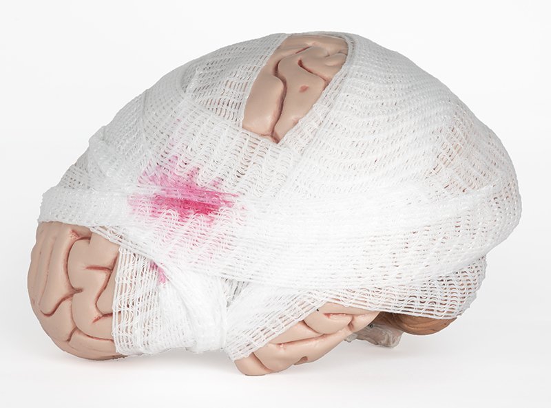Brain